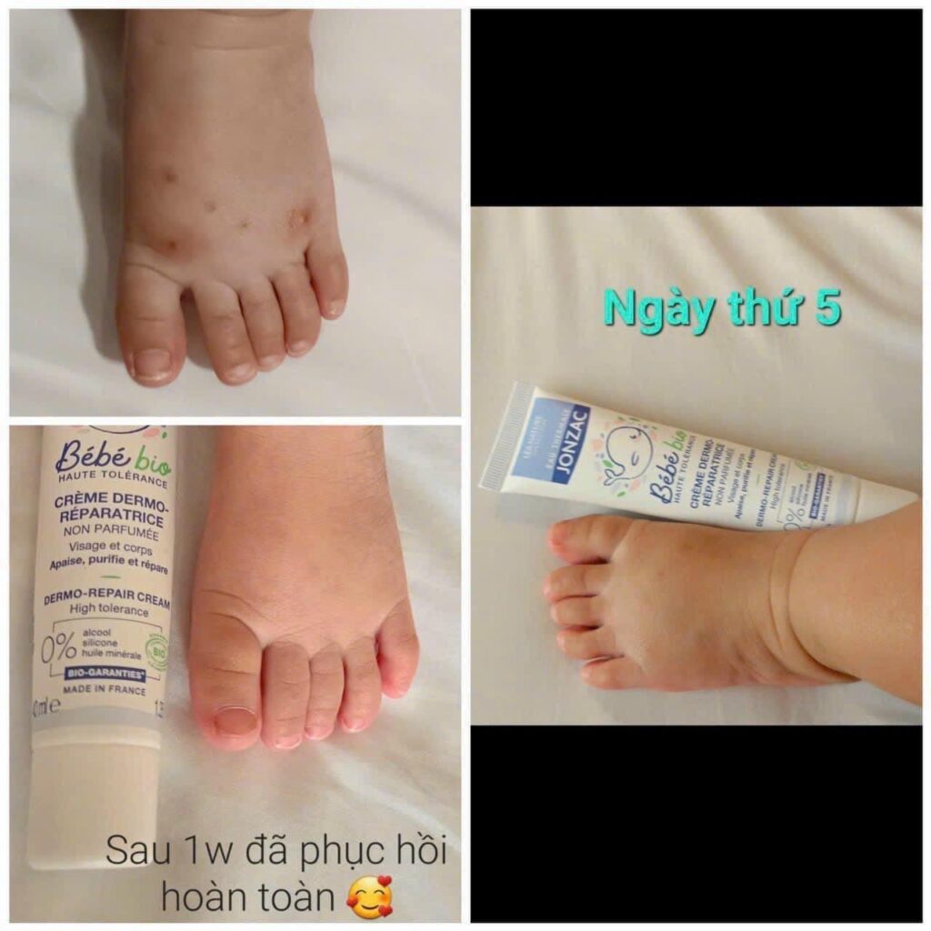 Kem dưỡng Jonzac hữu cơ chống hăm & phục hồi 40ml 17 Kem Dưỡng Jonzac Hữu Cơ Chống Hăm & Phục Hồi 40ml (4)