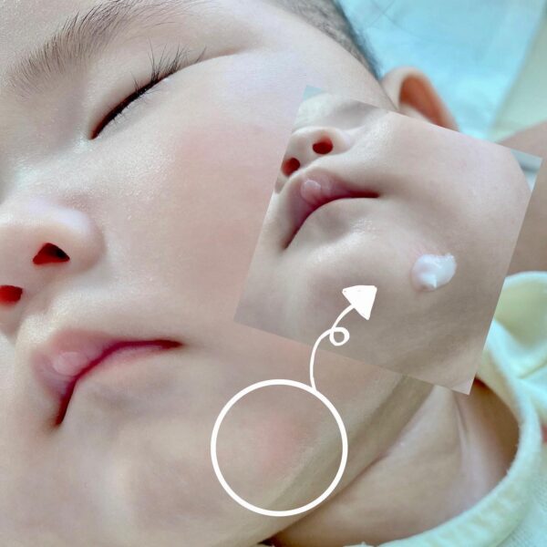 Kem phục hồi chuyên biệt Atono2 SOS Cream cho bé 20ml 13 Kem Phục Hồi Chuyên Biệt Atono2 Sos Cream Cho Bé 20ml (3)