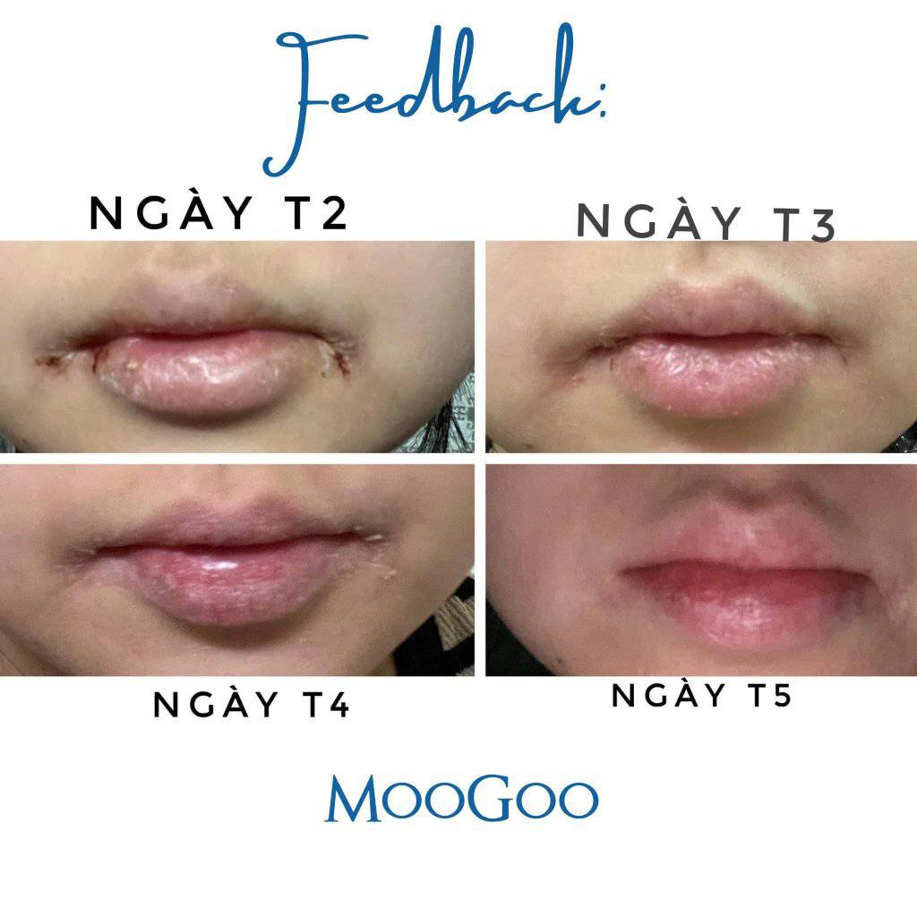 Son dưỡng môi Vanilla Dream Moogoo 5g 26 Son Dưỡng Môi Vanilla Dream Moogoo 5g (7)